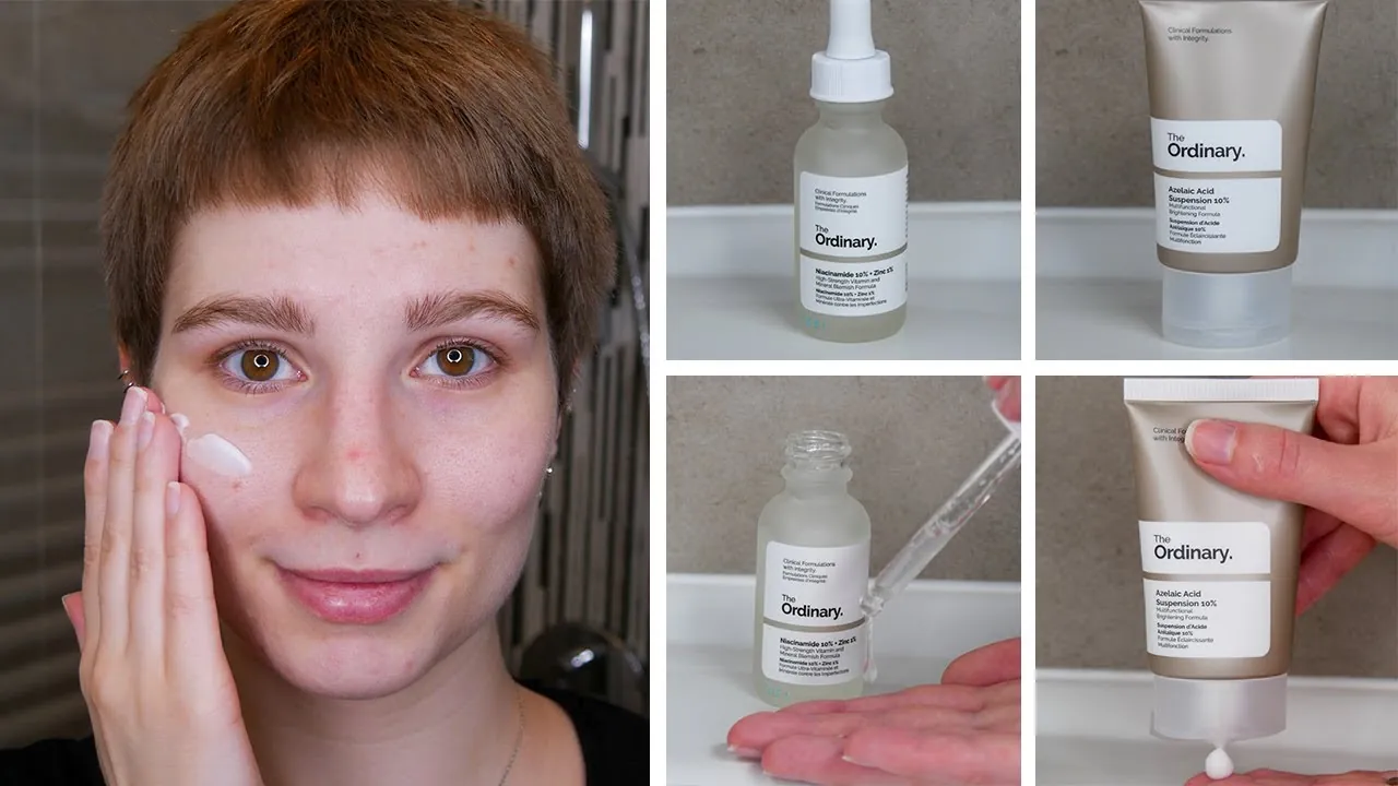 Close-up views of different skin types help determine suitability for azelaic acid and niacinamide.